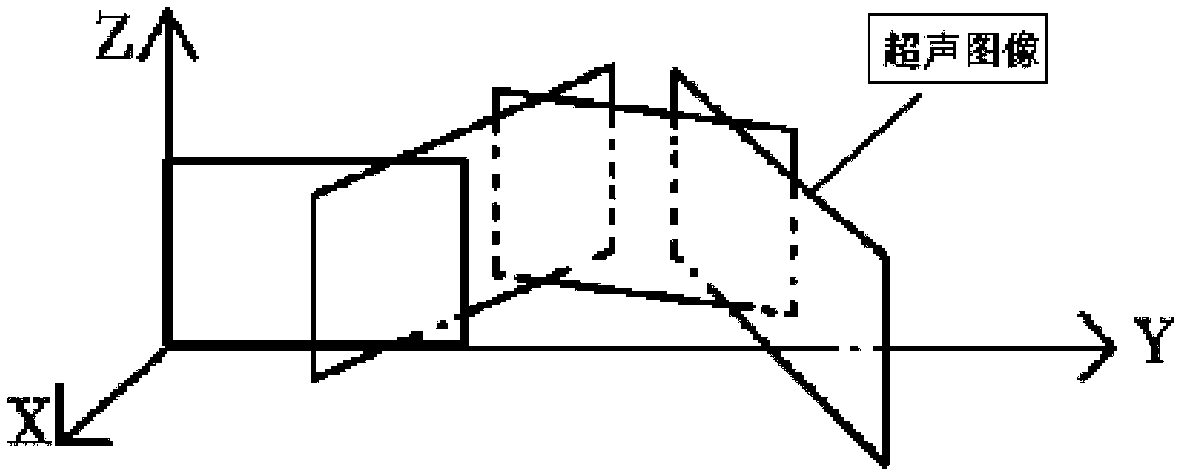 Wireless curved plane extended field-of-view ultrasound imaging method and device