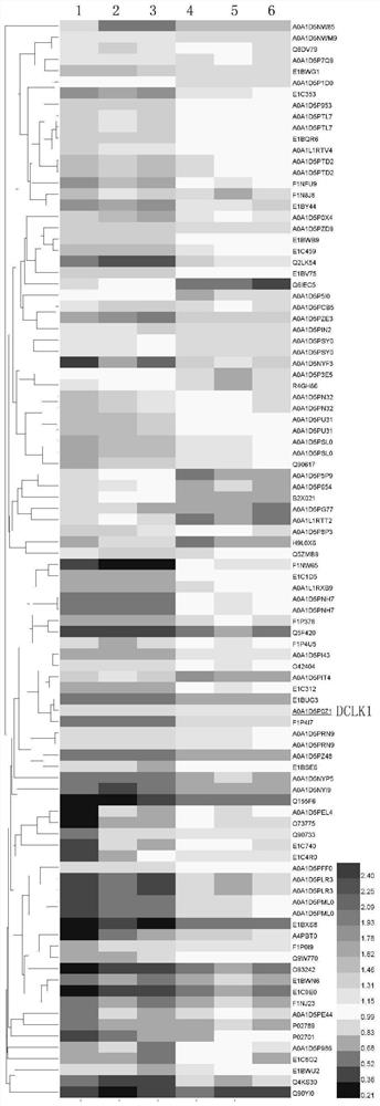 New application of doublecortin-like kinase 1