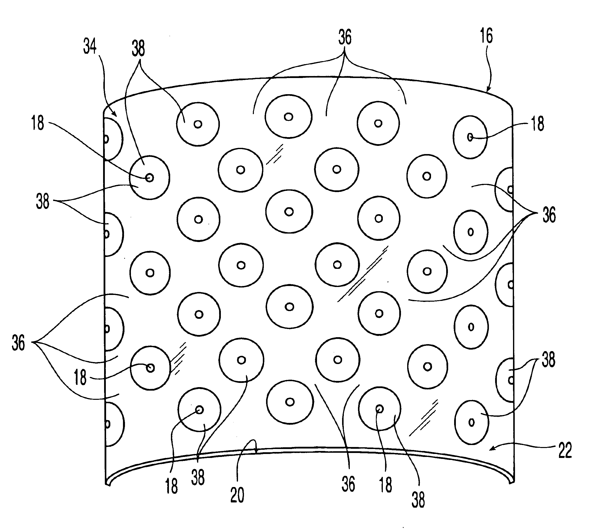 Demineralized bone-derived implants