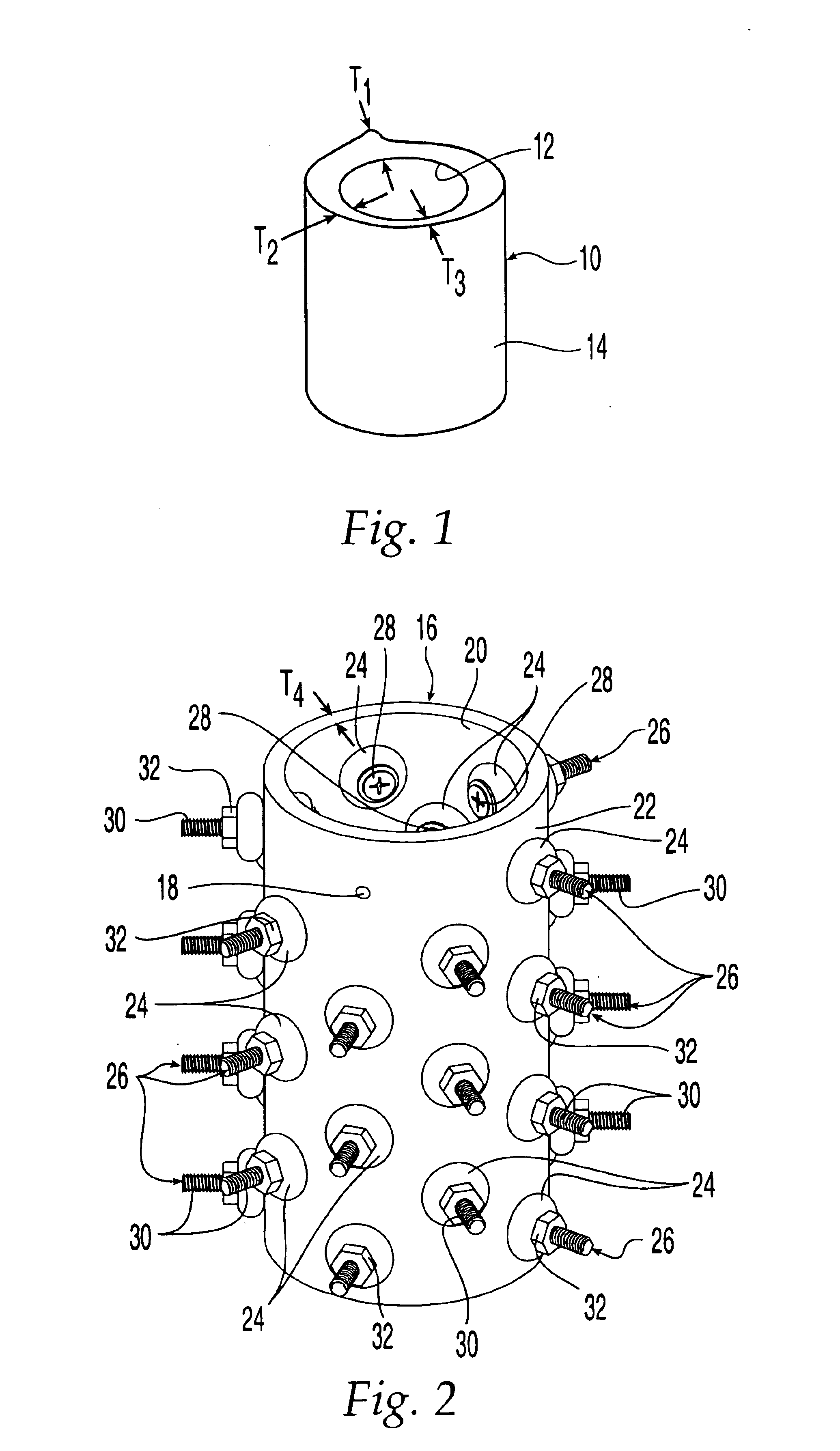 Demineralized bone-derived implants