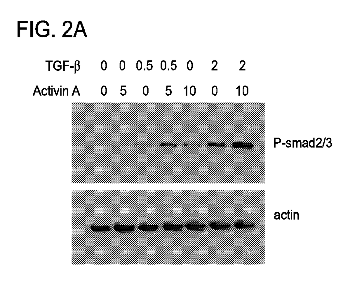 Compositions and methods for targeting activin signaling to treat cancer