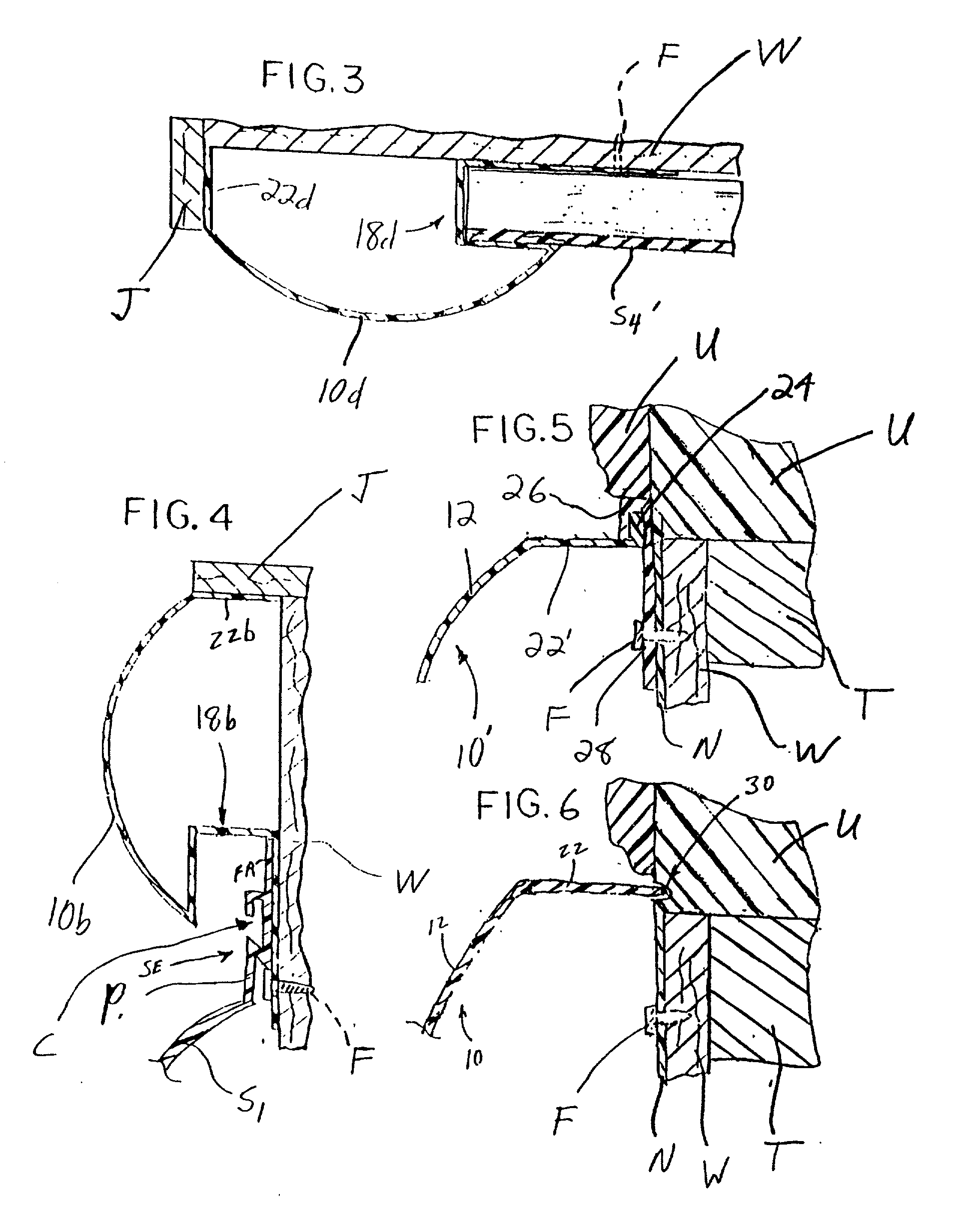 Trim component for use in a siding system