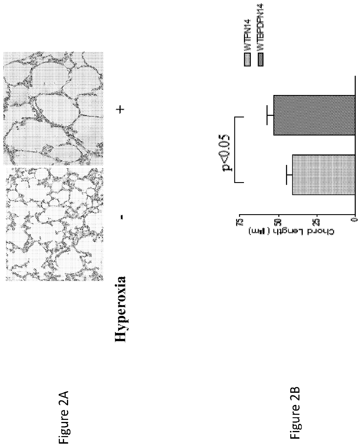 Compositions and methods of inhibiting gene expression in a lung