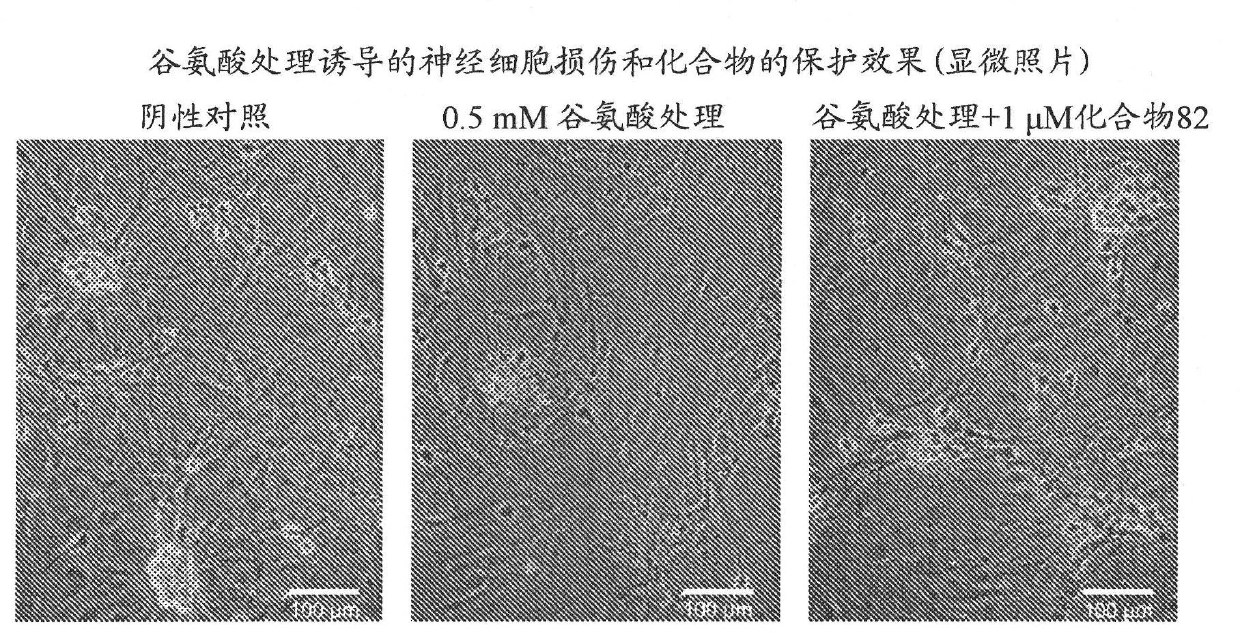 Pyrimidine derivative having cell-protecting activity and use thereof