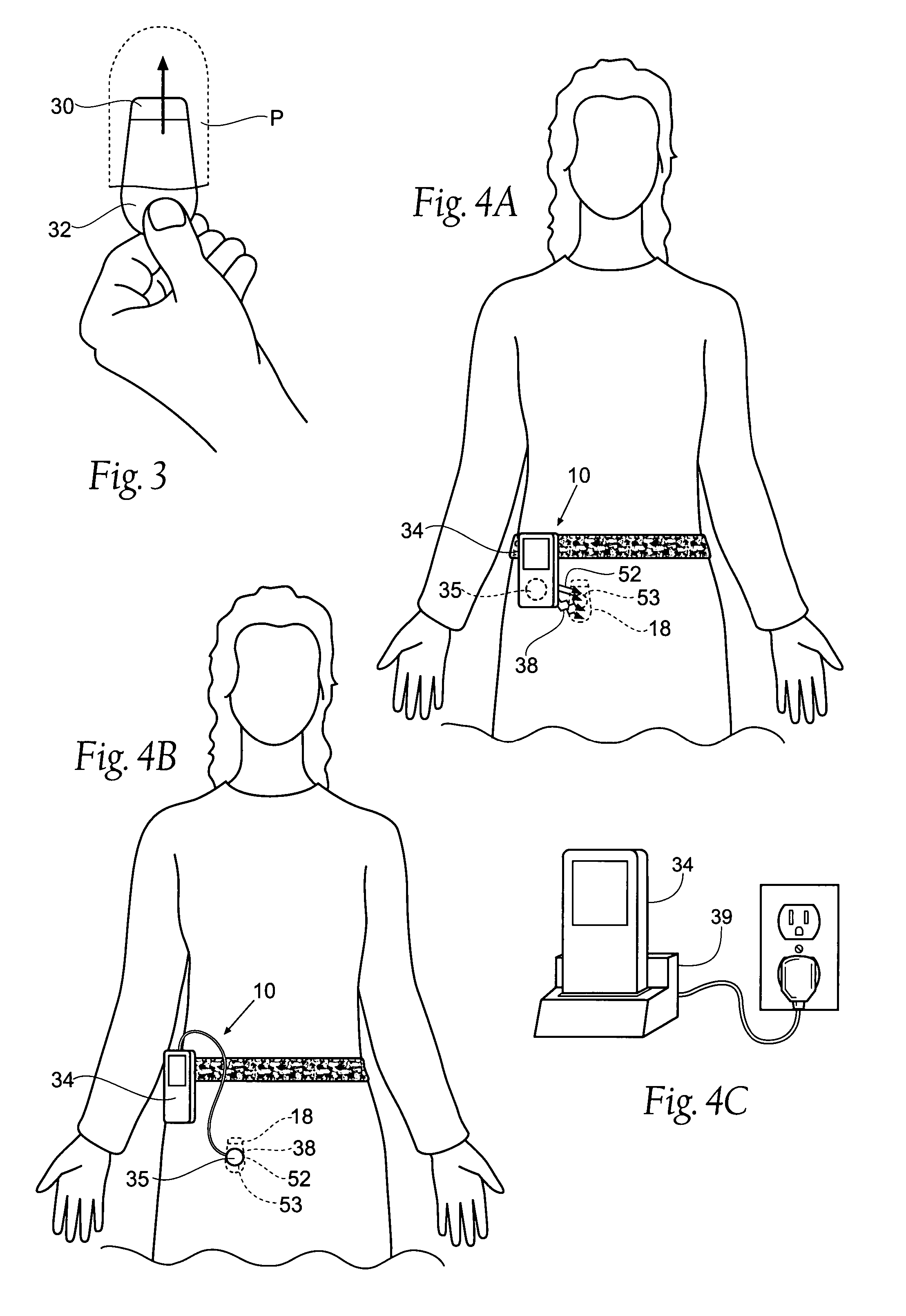 Implantable pulse generator power management