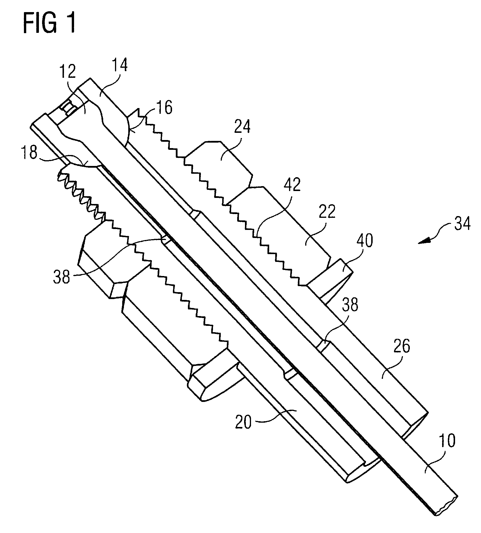 Suspension rod tensioning arrangements for supporting cryogenic equipment within a cryostat