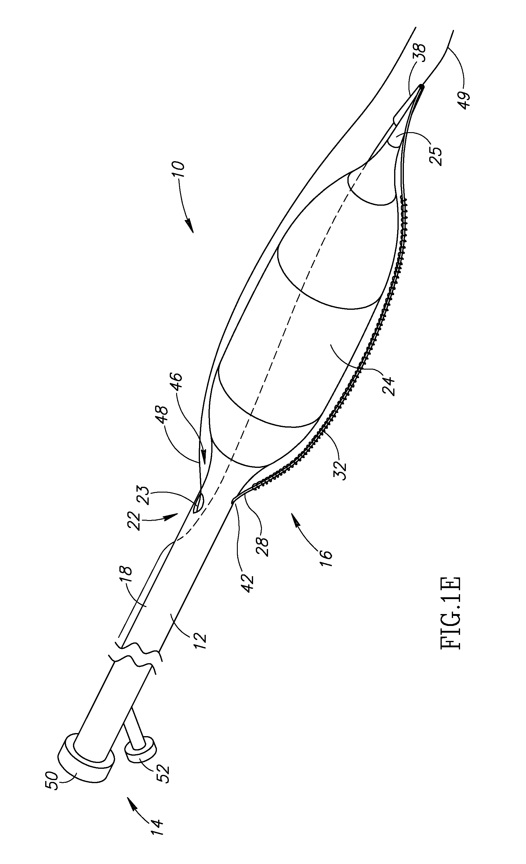 Systems and methods for treating a vessel using focused force