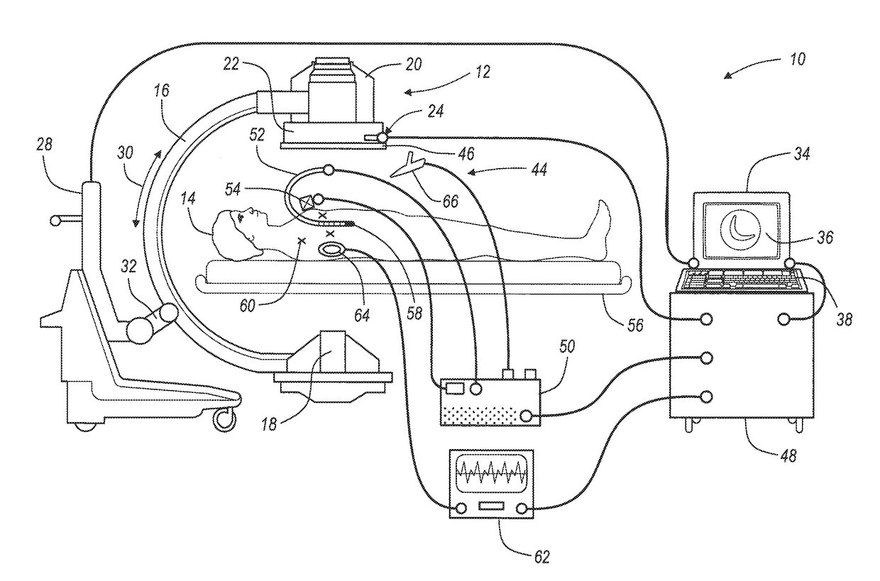 Navigation system for cardiac therapies using gating