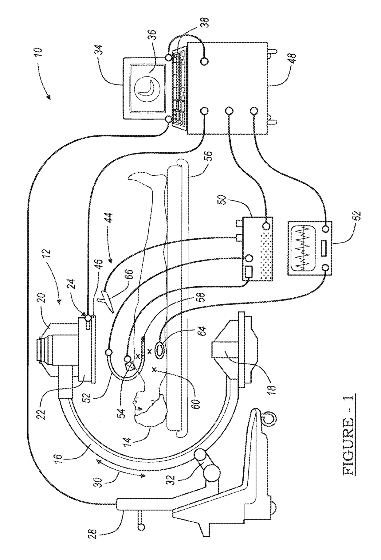 Navigation system for cardiac therapies using gating