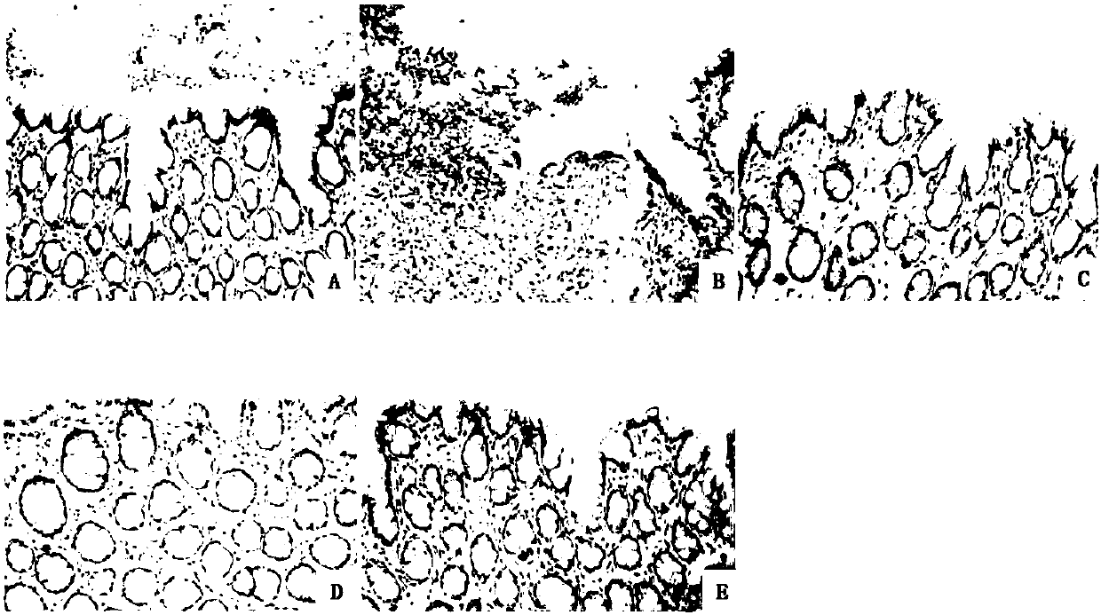 Lindera aggregata compound with antagonistic effect for inflammatory bowel diseases and application thereof