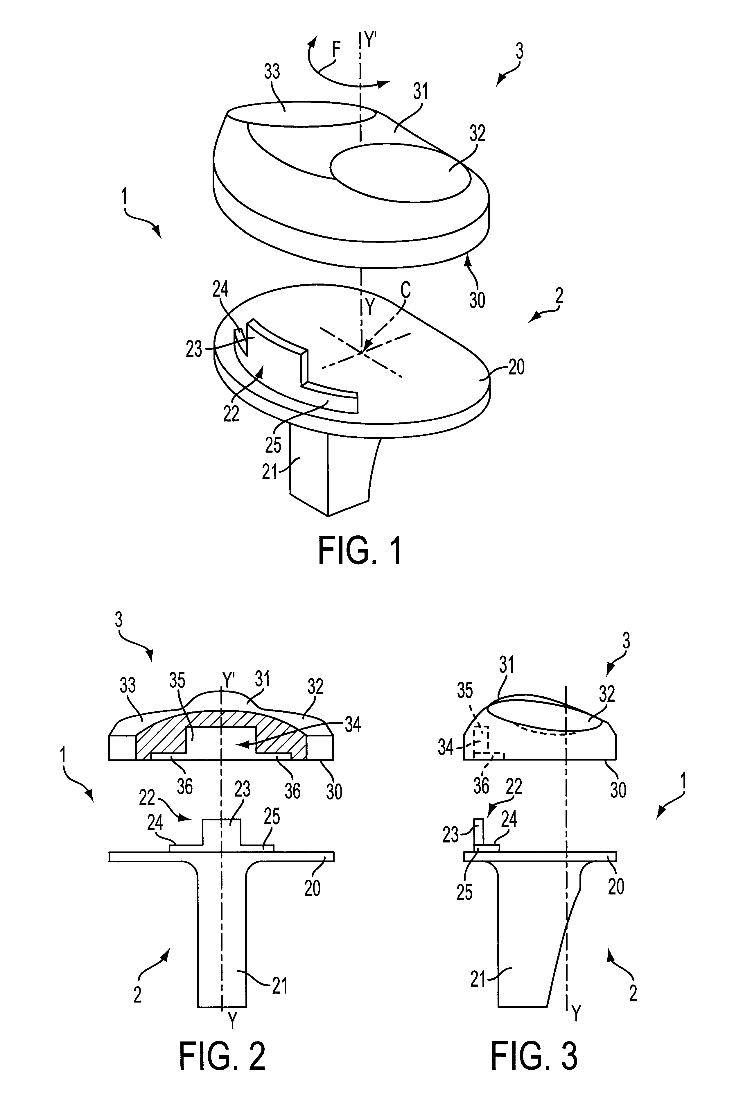 Knee prosthesis with a rotational plate