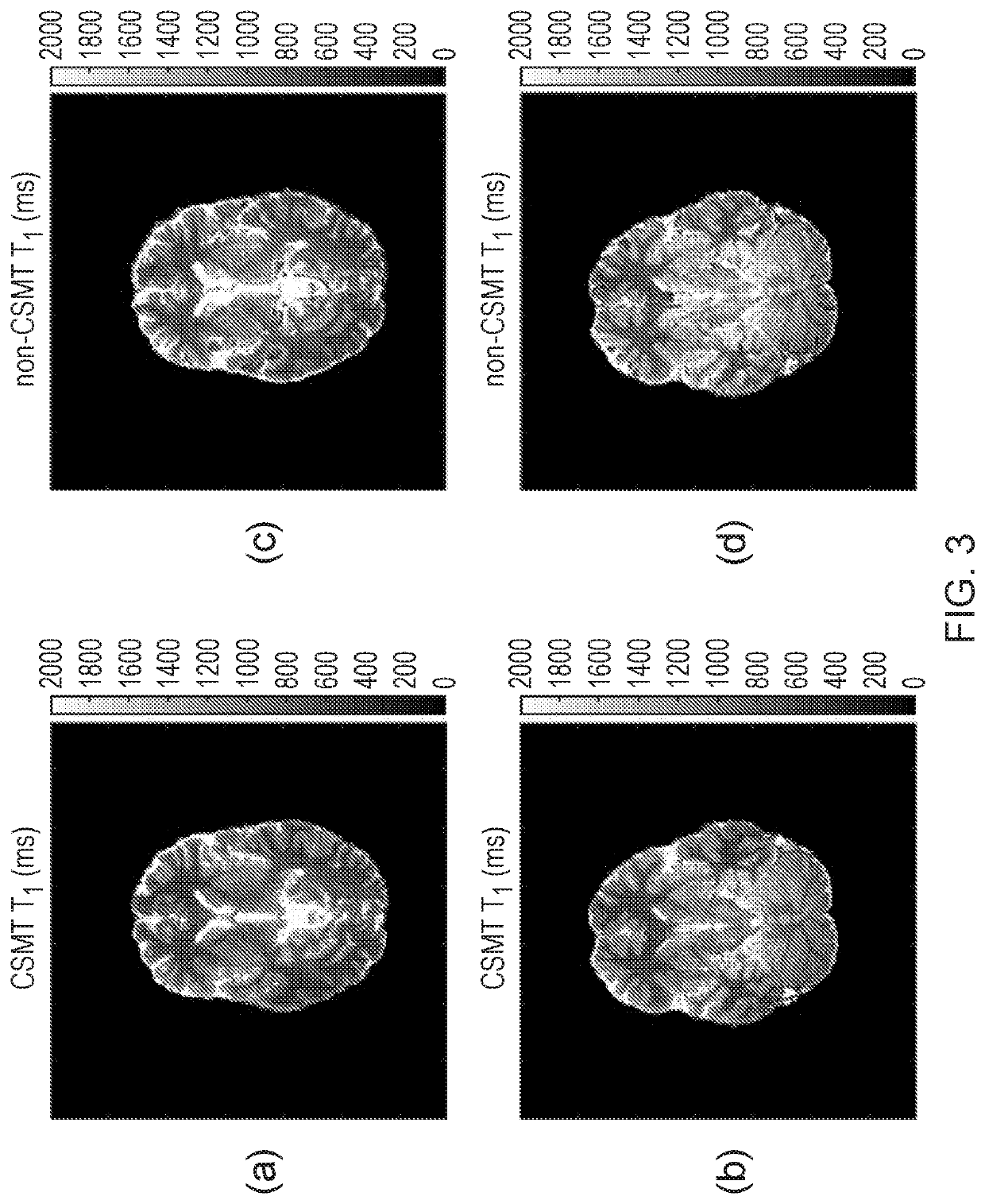 Controlled excitation and saturation of magnetisation transfer systems