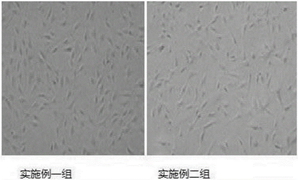 Adipose-derived stem cell serum-free culture medium and preparation method and application thereof