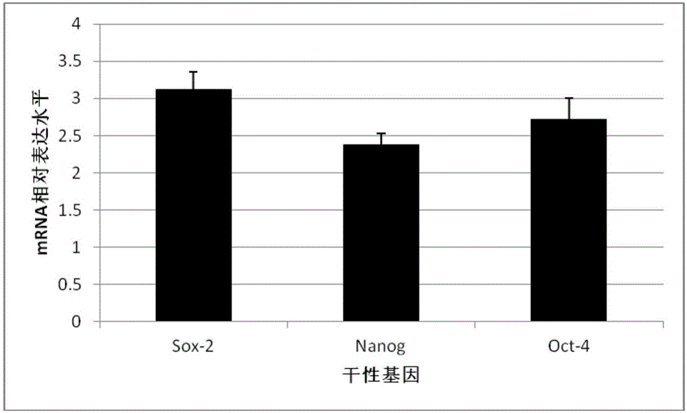 Adipose-derived stem cell serum-free culture medium and preparation method and application thereof