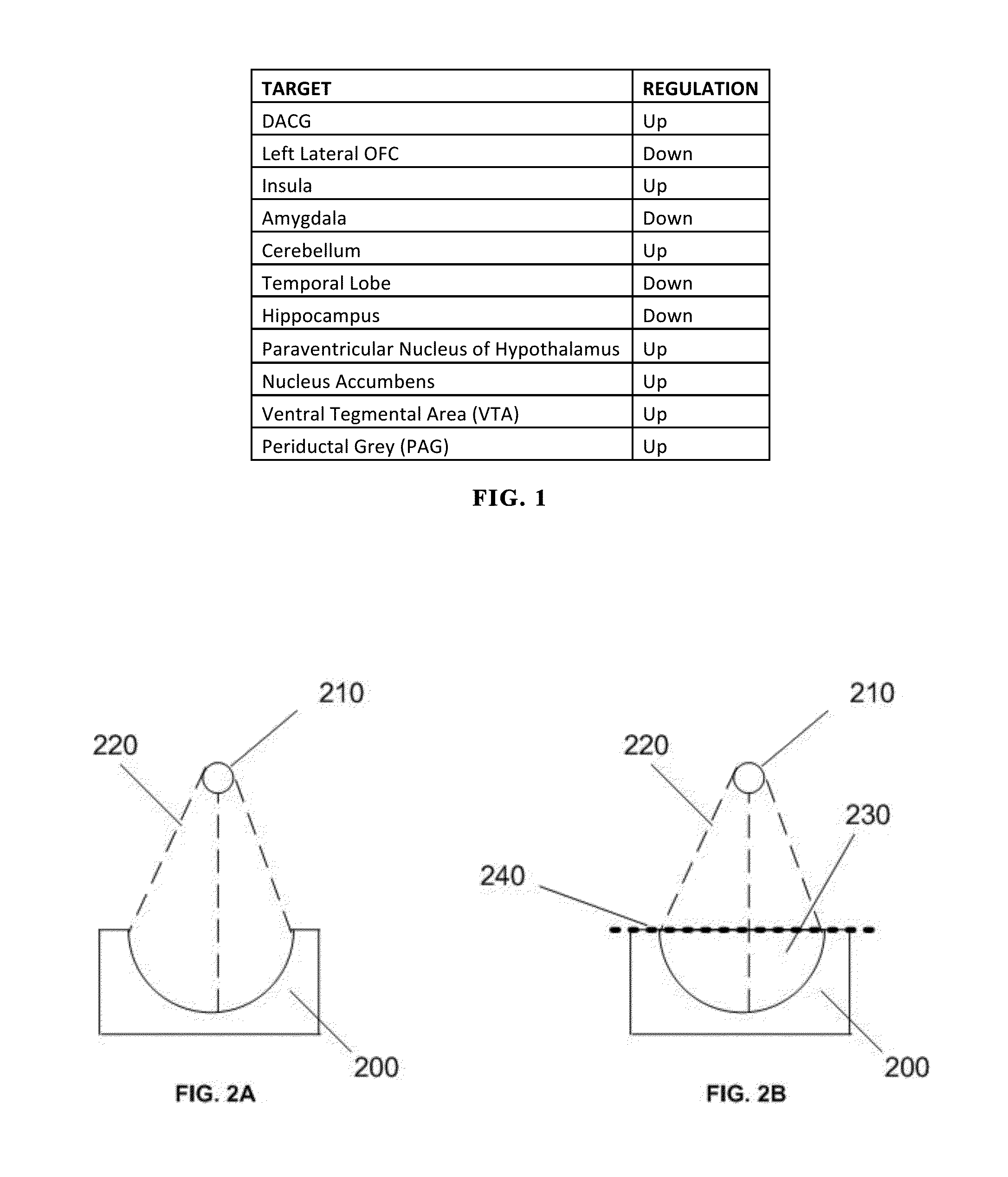 Stimulation method via deep-brain stimulation