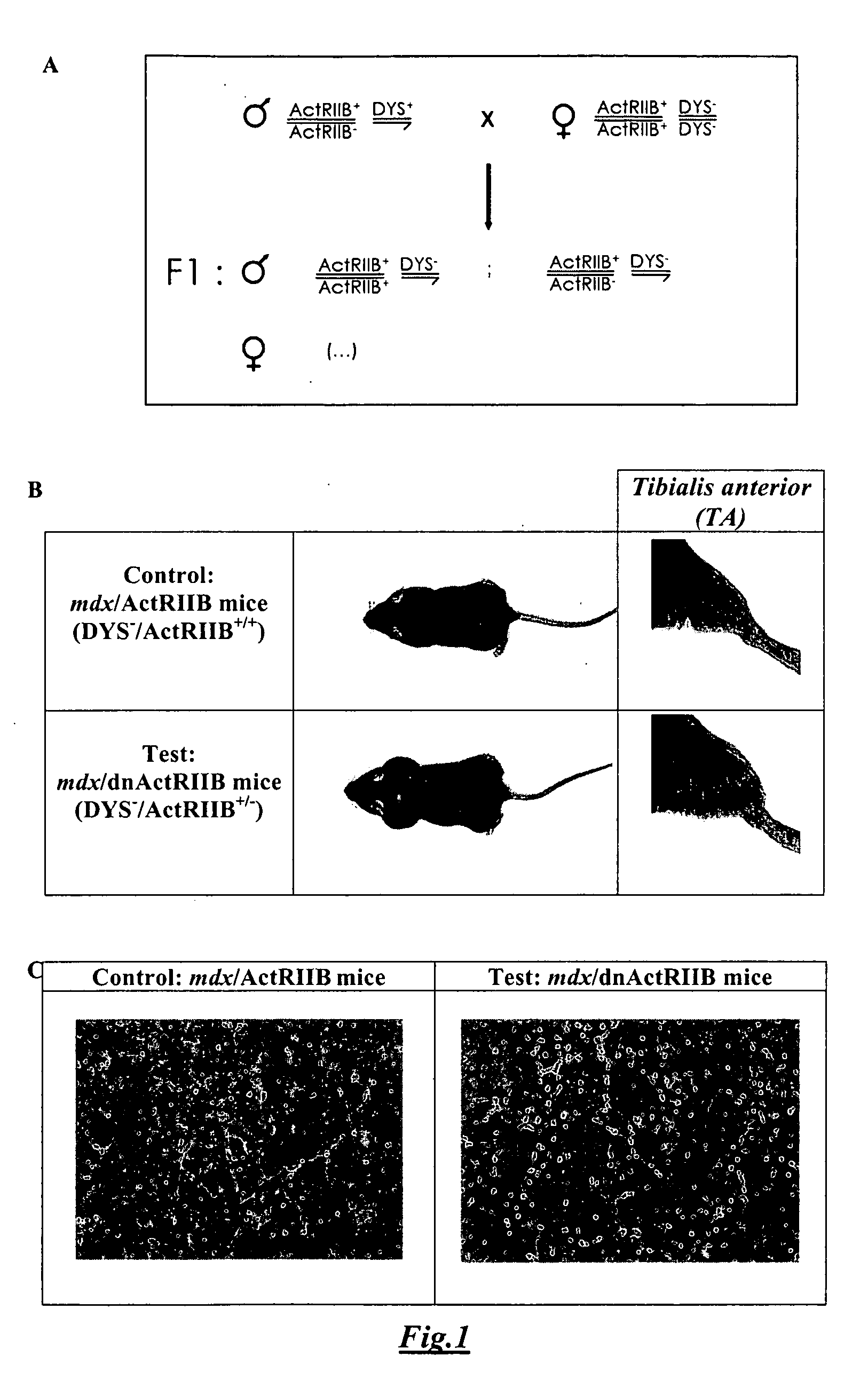 Modulation of myostatin and use thereof in cell transplantation-based treatment of muscle disease