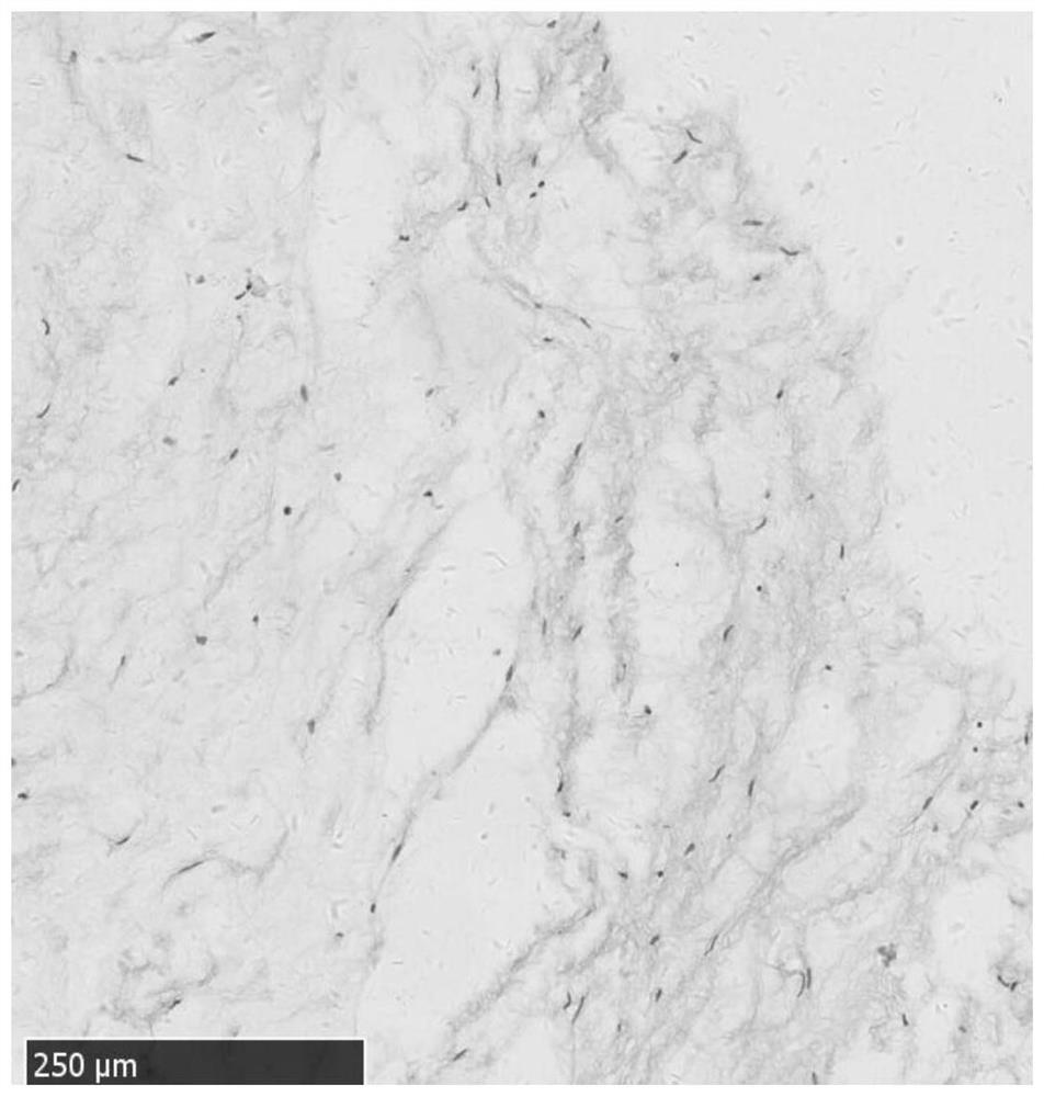 Preparation and cryopreservation method and application of human placental chorionic tissue