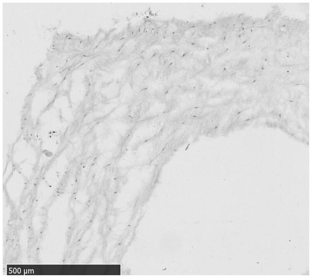 Preparation and cryopreservation method and application of human placental chorionic tissue