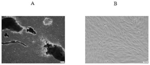 Application of circRNA PRKD3 to osteogenic differentiation of periodontal ligament stem cells