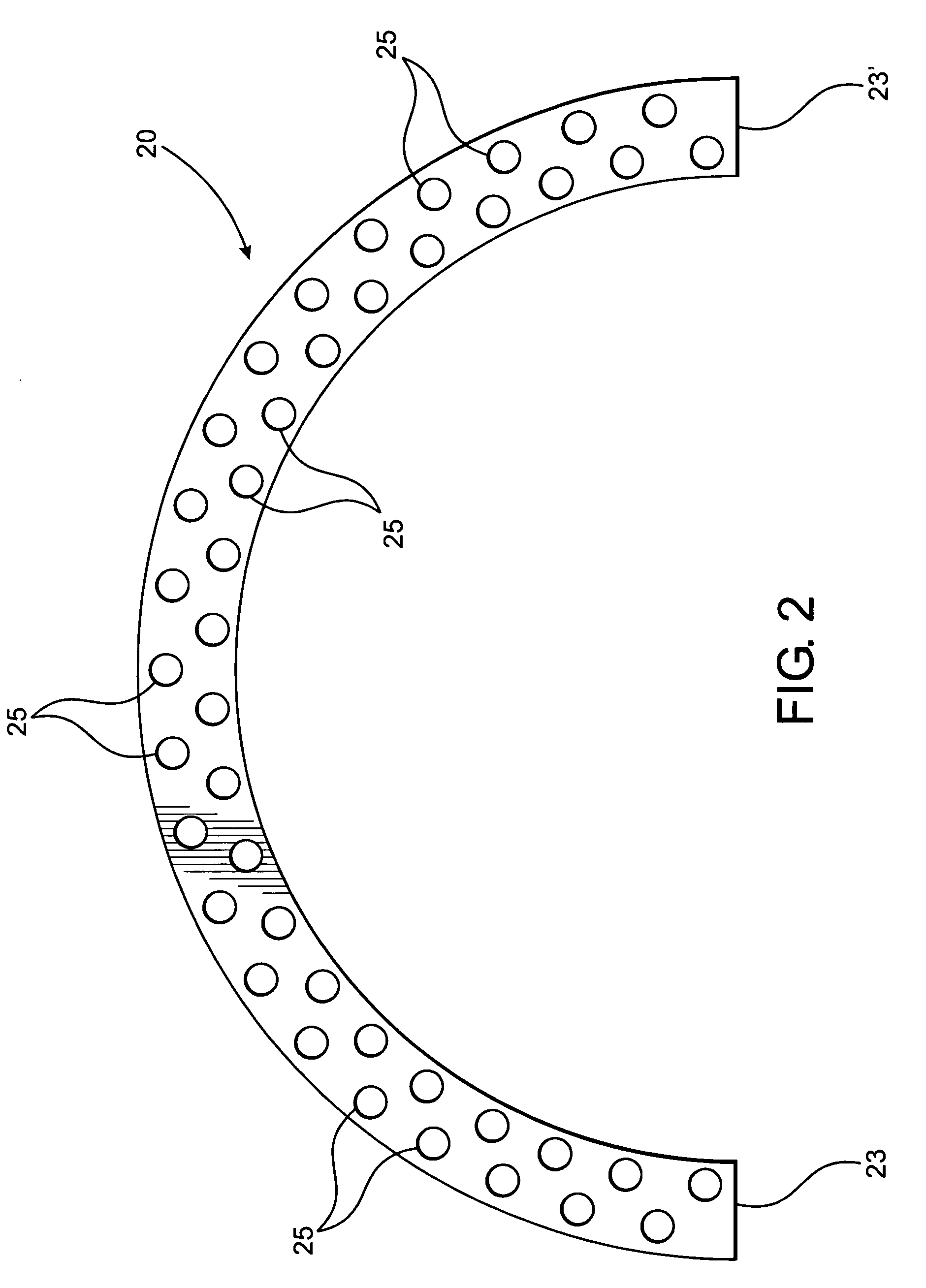 External fixator assembly