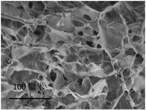 In-situ gelation chemotherapy and immunotherapy combined biopolymer pharmaceutical composition