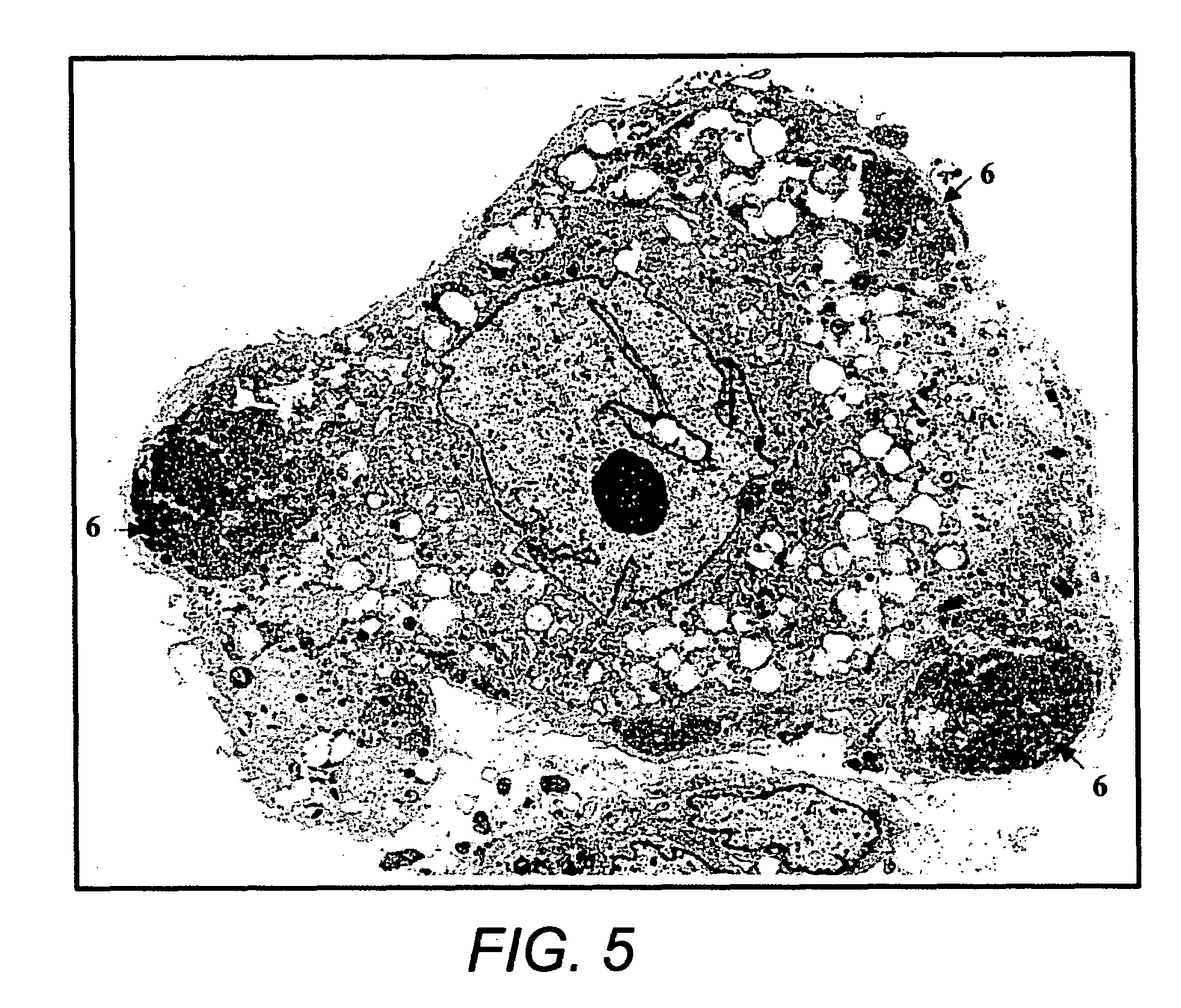 Method for purifying pluri-differentiated mesenchymal progenitor cells