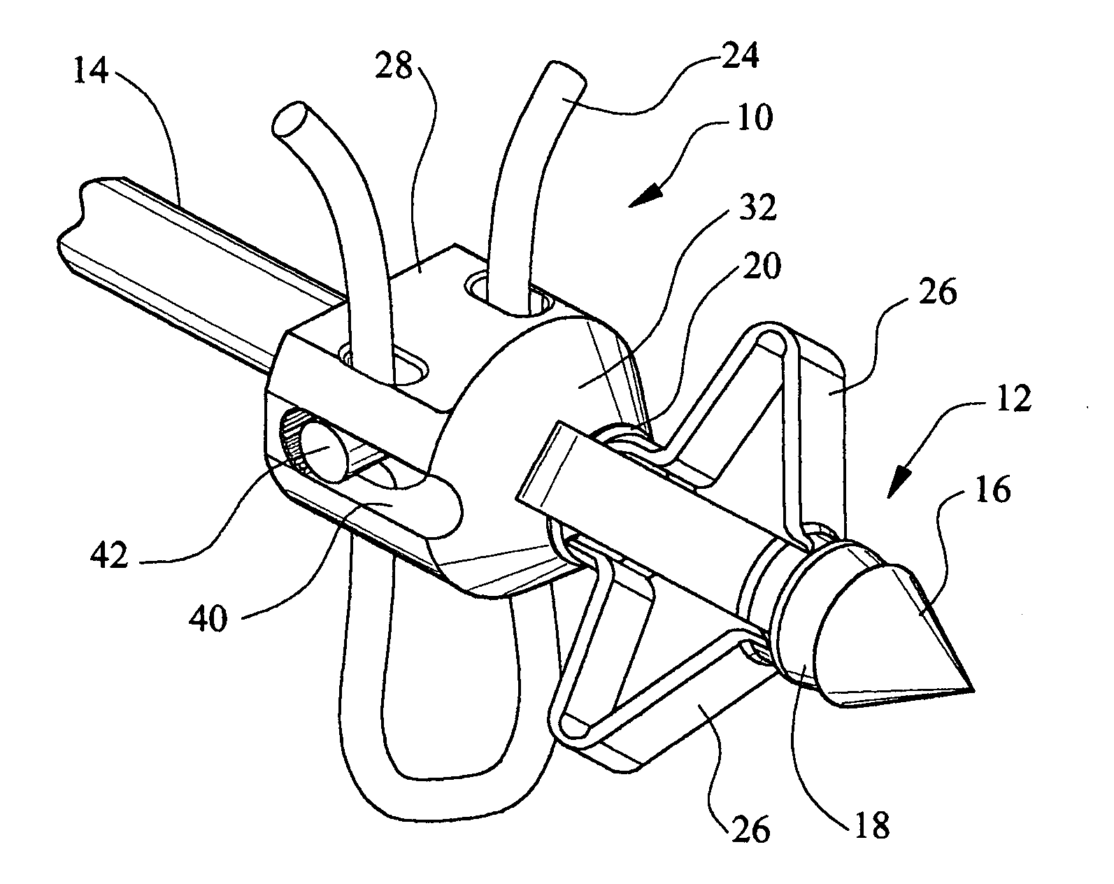 Anchor/suture used for medical procedures