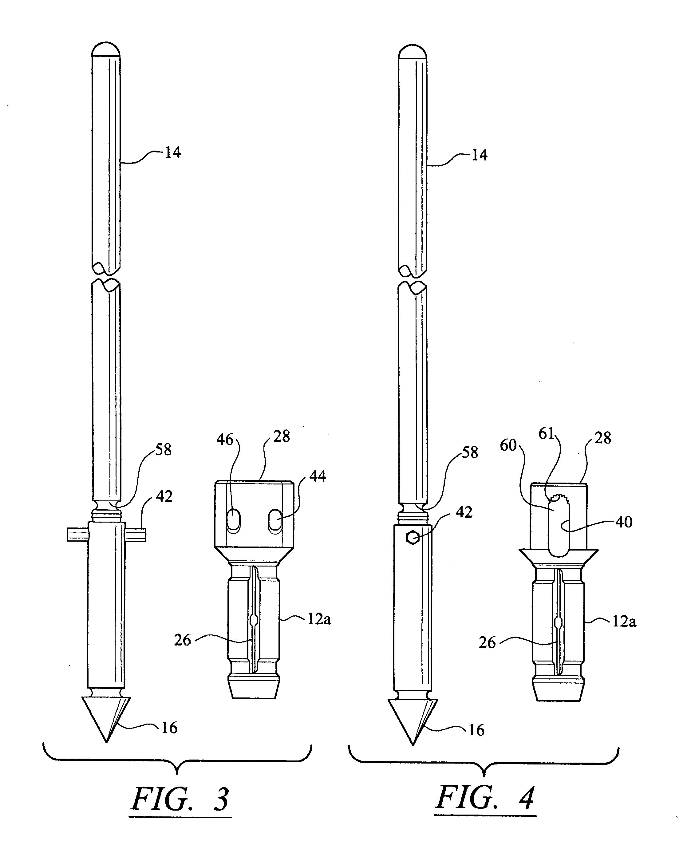 Anchor/suture used for medical procedures