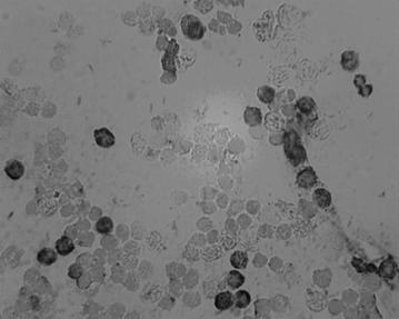 MRNA level in-situ hybridization detection kit for beta-catenin of liver cancer prophase as well as detection method and application of mRNA level in-situ hybridization detection kit