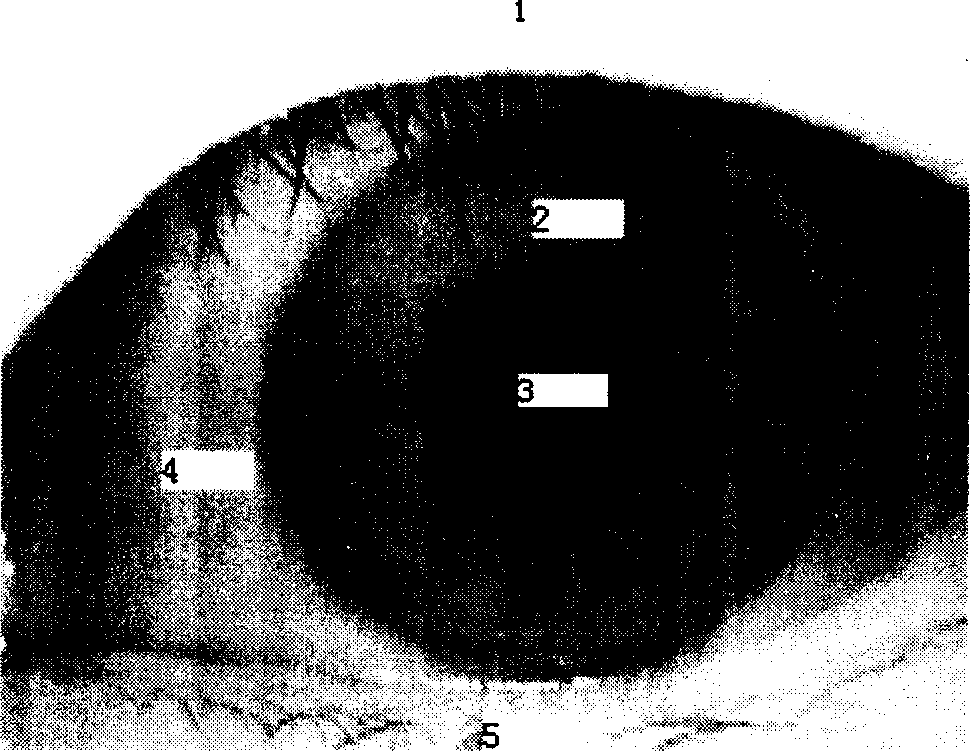 Iris positioning method based on morphology and probability statistic