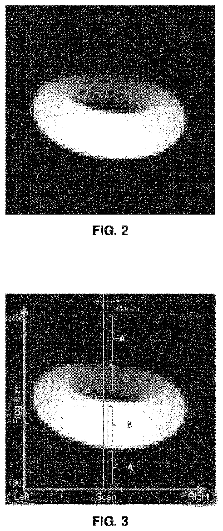 Portable system that allows blind or visually impaired persons to interpret the surrounding environment by sound and touch