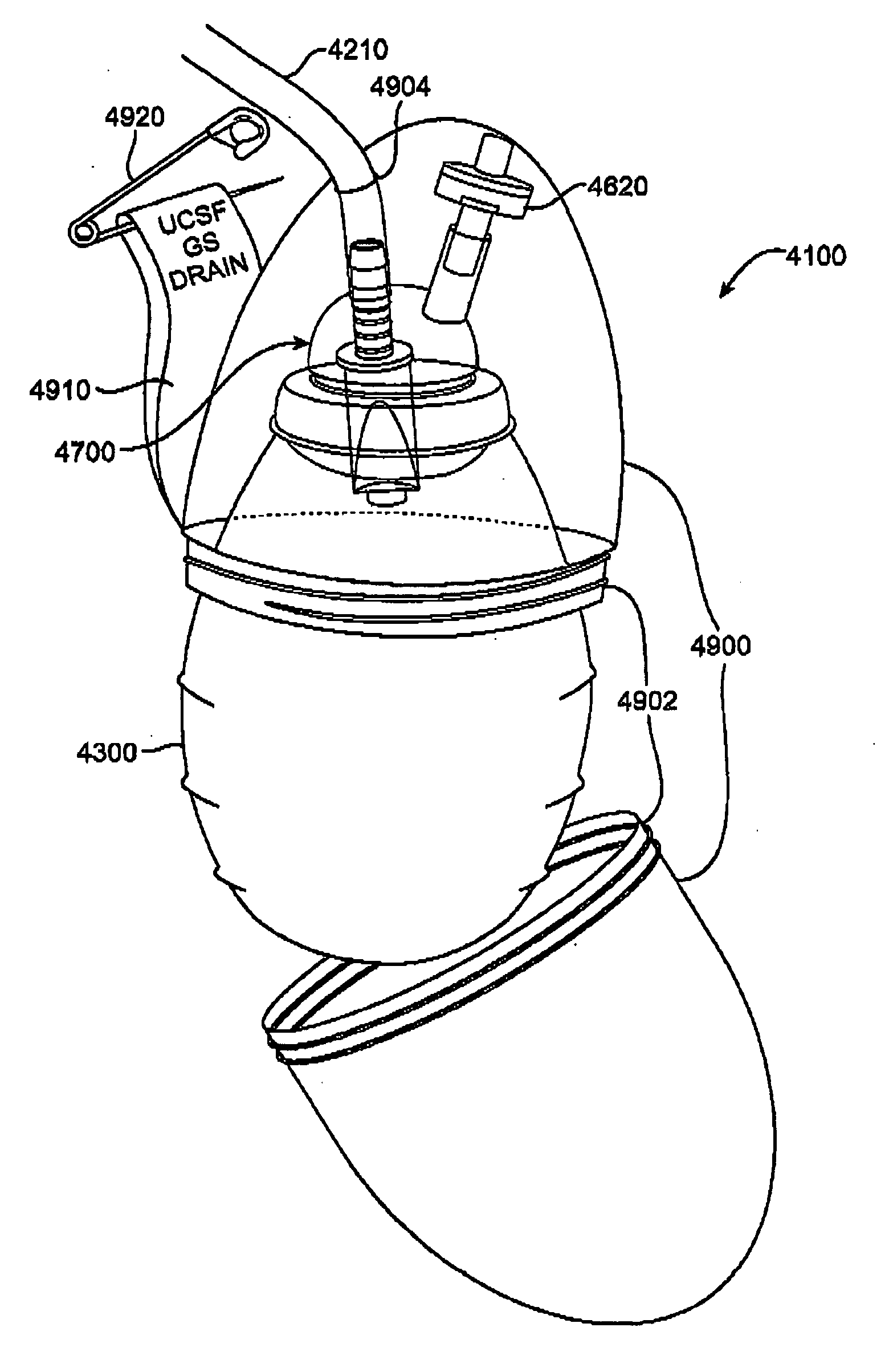 Drainage devices and methods