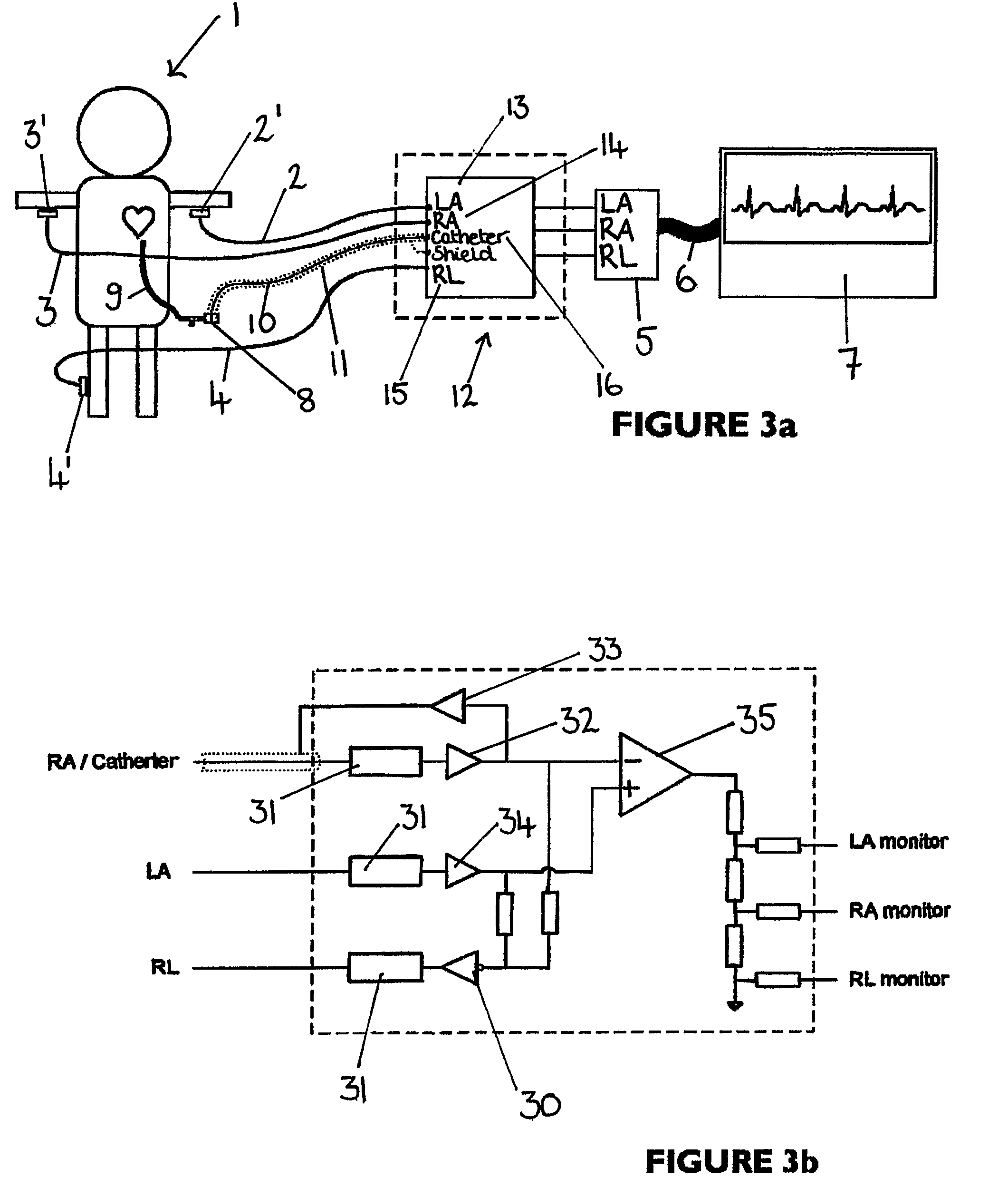 Apparatus for detecting the position of a percutaneously-inserted intravenous catheter