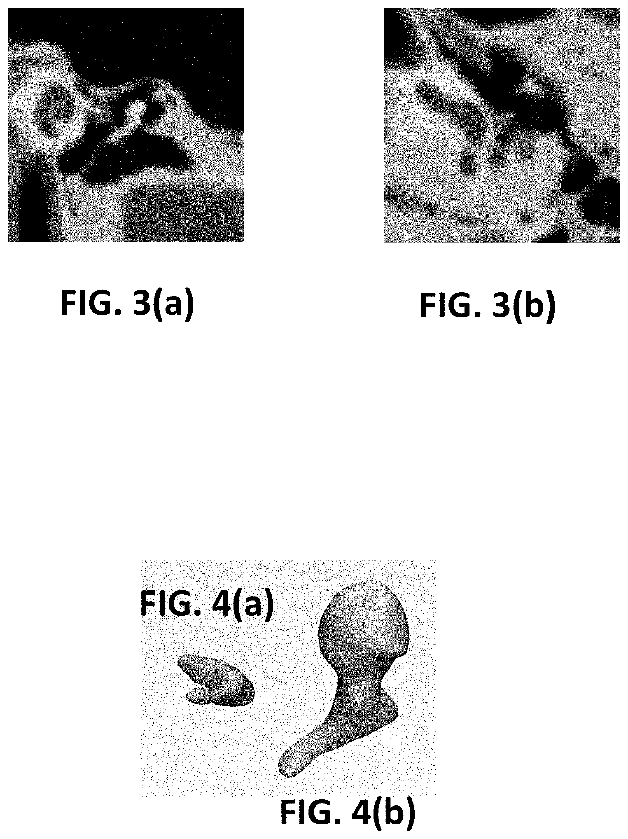 Ossicular prosthesis and method and system for manufacturing same