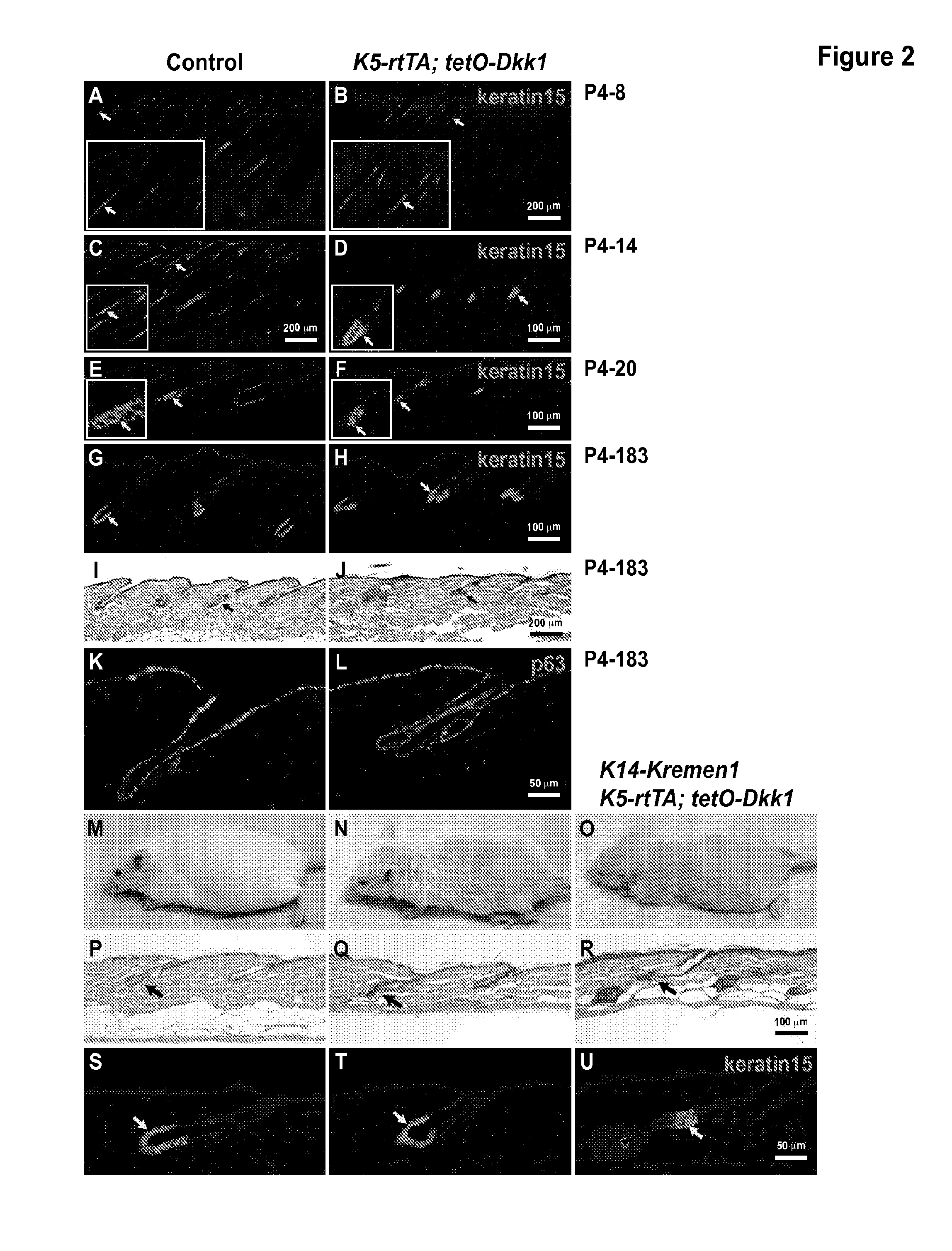 Inhibition of hair follicle growth by the wnt inhibitor dkk1