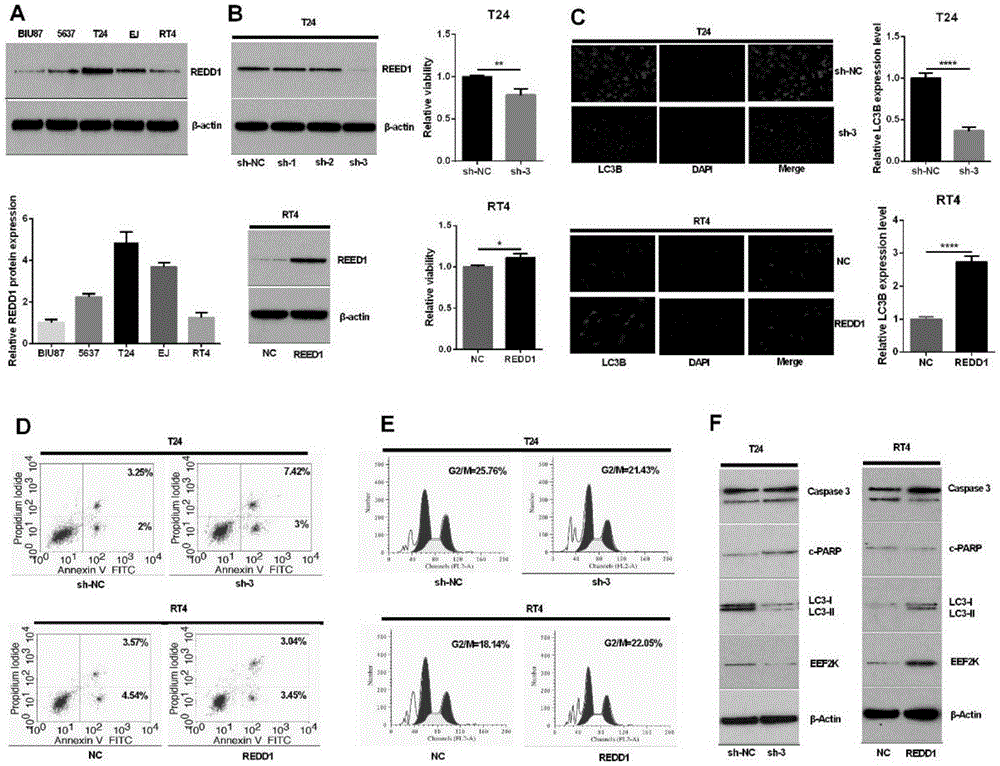 Application of miR-22 in preparation of bladder cancer chemosensitization treatment drugs as target site