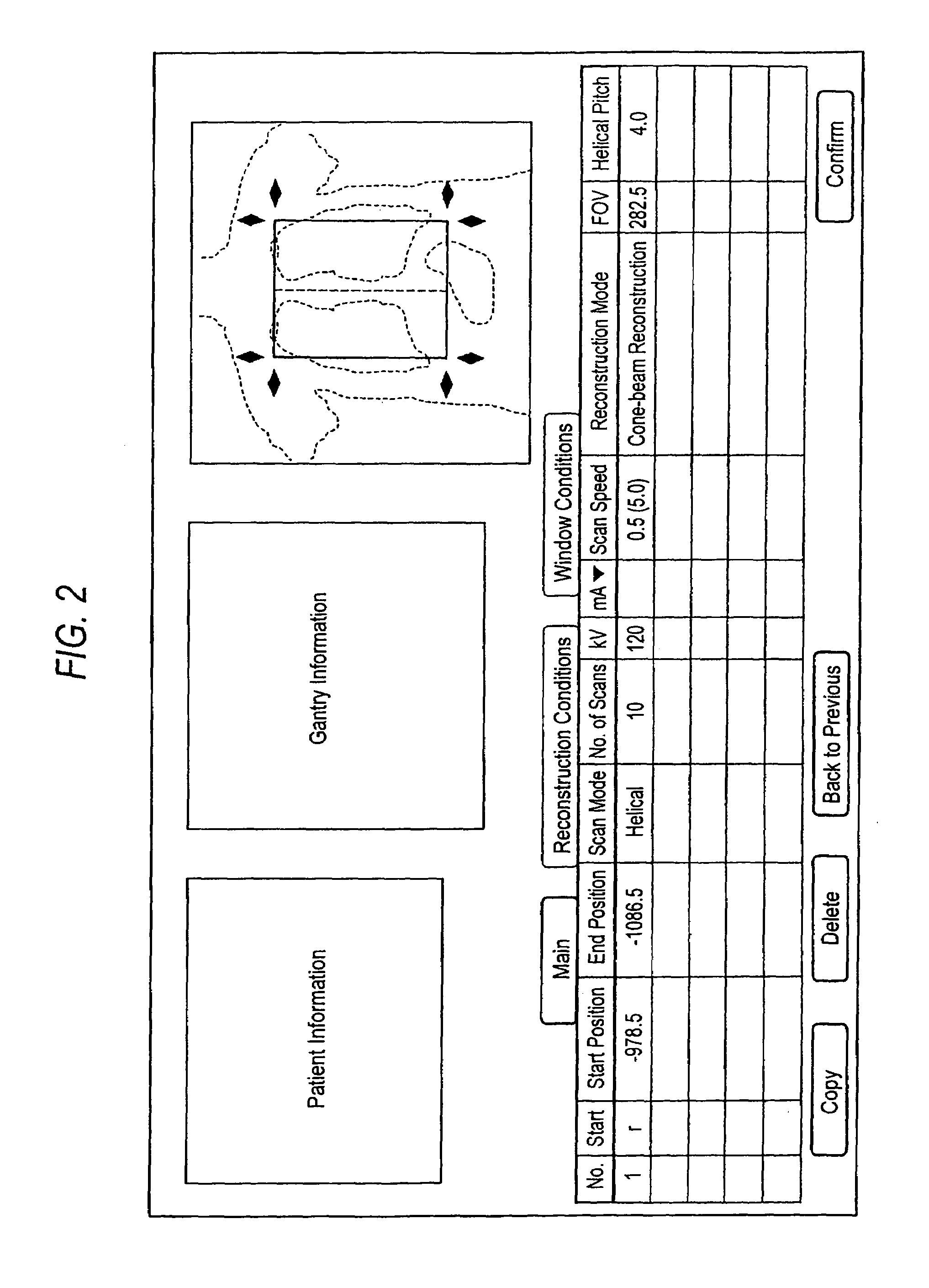 X-ray computed tomographic apparatus