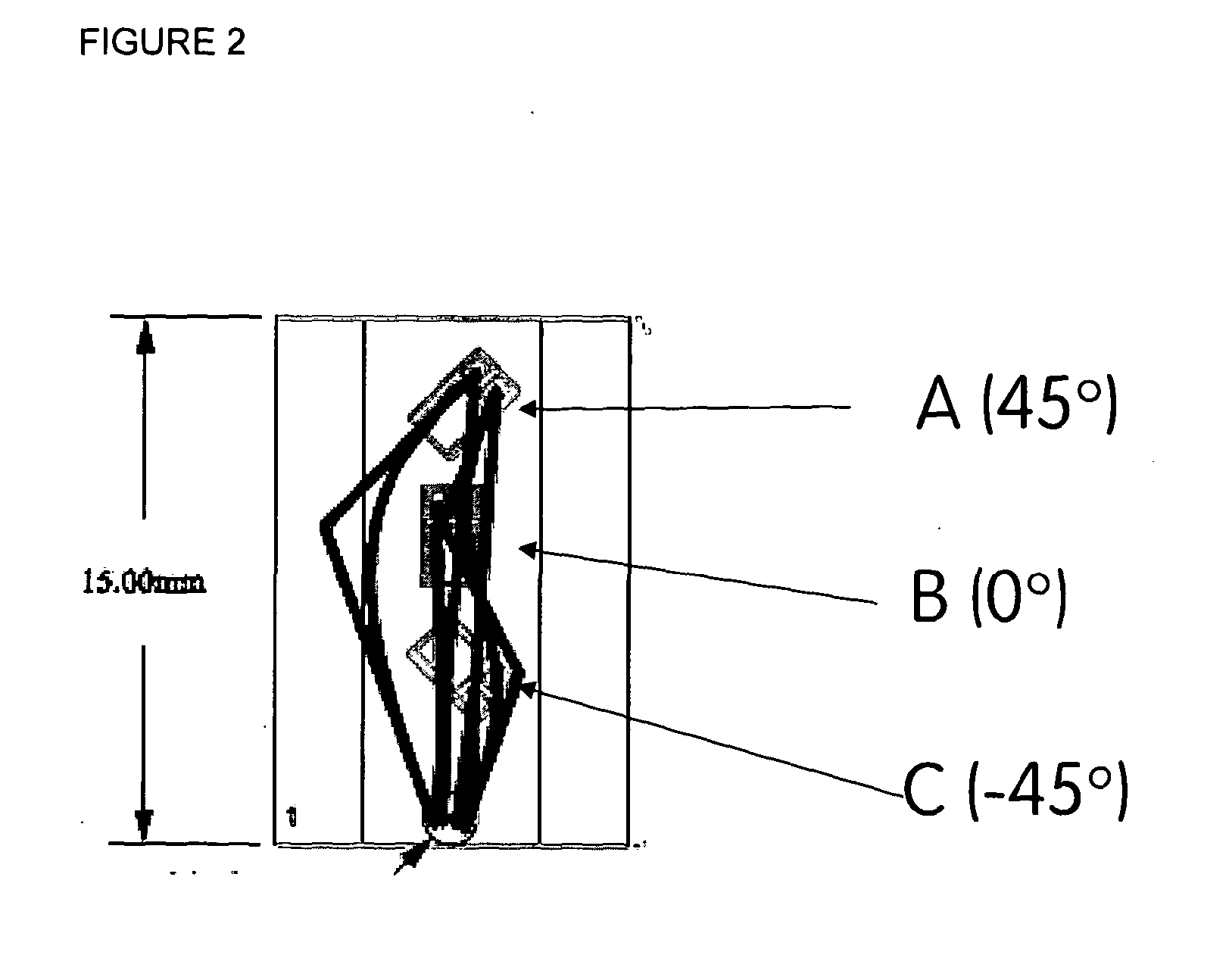 Telemetric orthopaedic implant