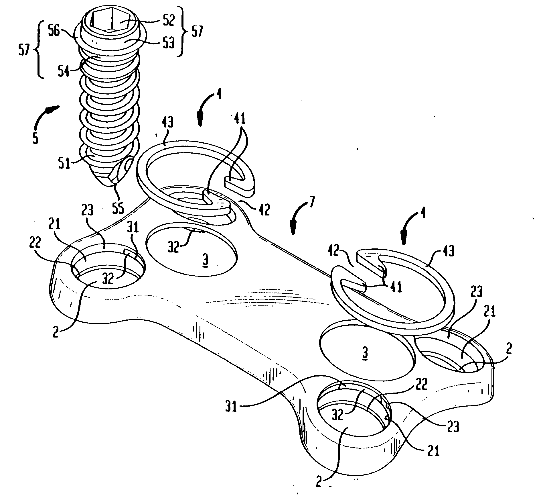 Bone screw retaining system