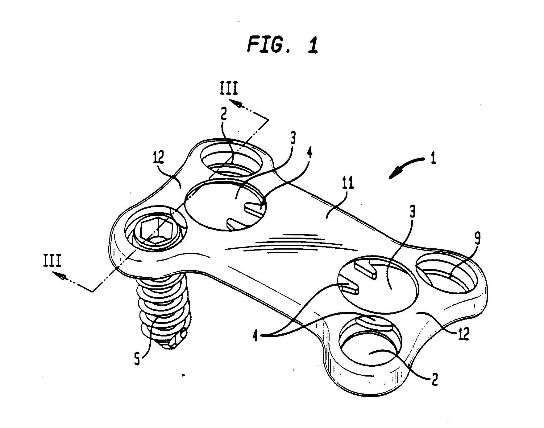 Bone screw retaining system