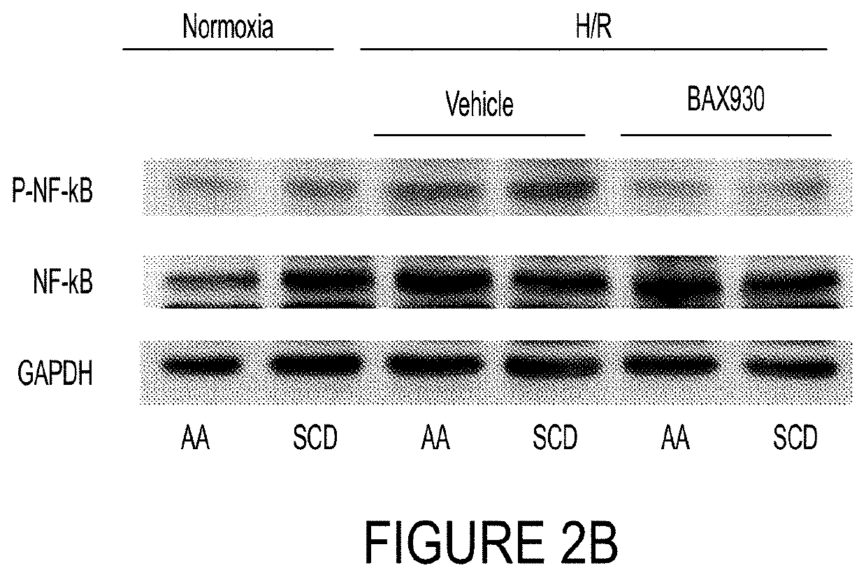 Use of ADAMTS13 for treating, ameliorating and/or preventing vaso-occlusive crisis in sickle cell disease, acute lung injury and/or acute respiratory distress syndrome