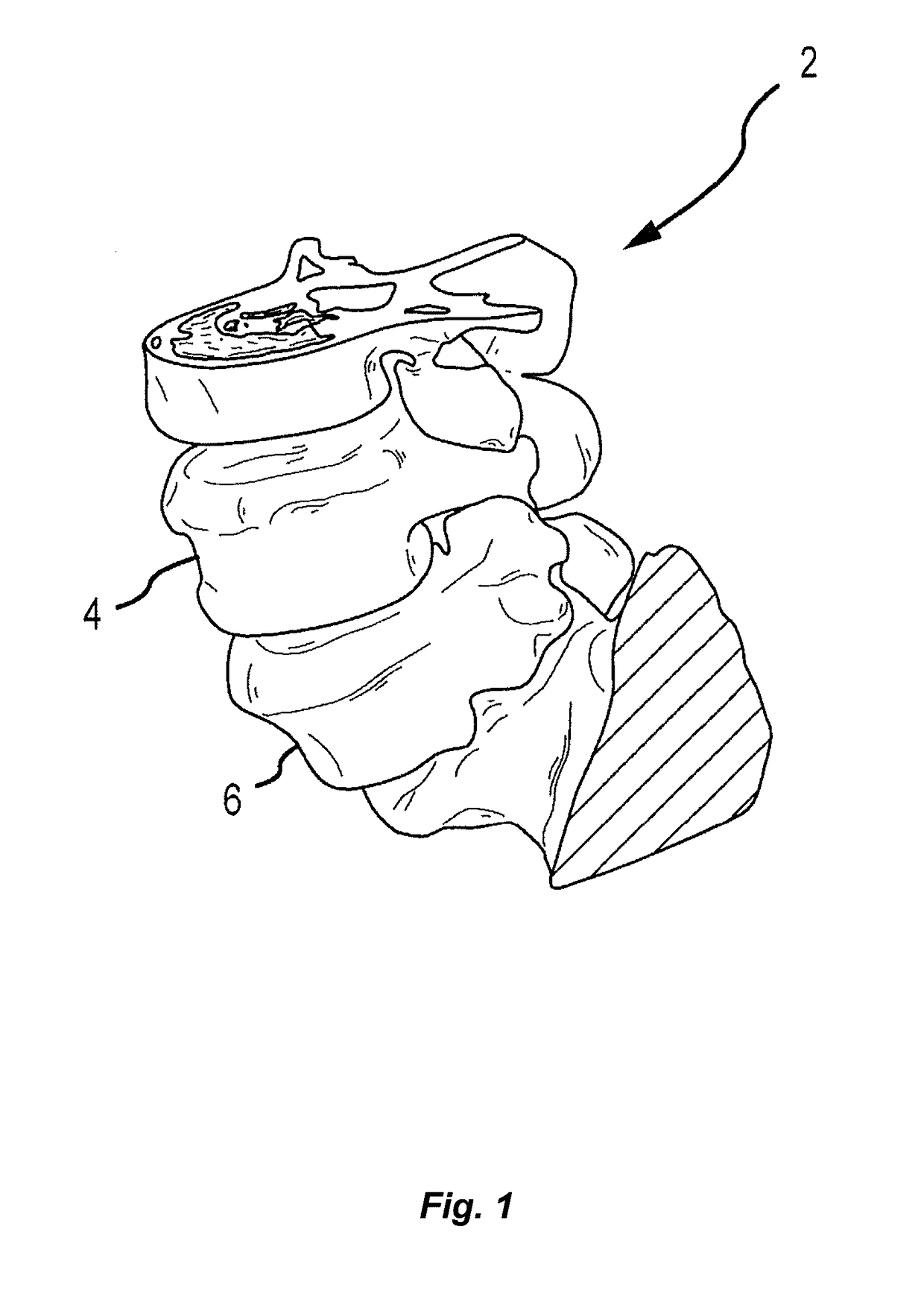 Patient-matched apparatus and methods for performing surgical procedures