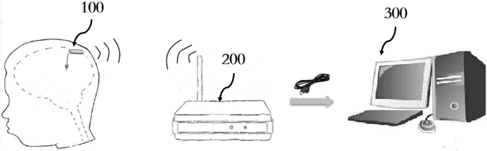 Airbag-based implantable wireless intracranial pressure monitoring system