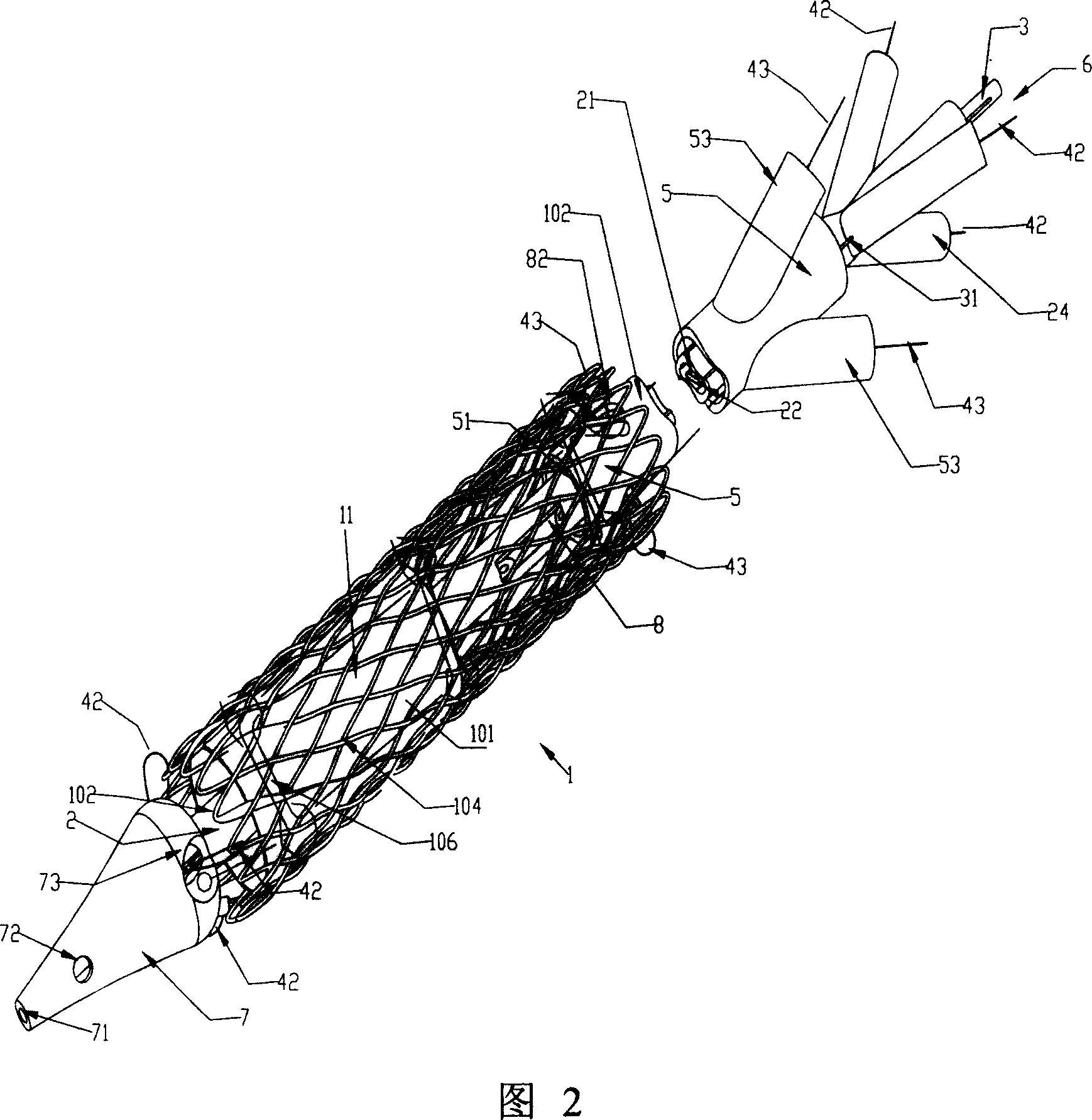 Self-expanding stent axial wire-drawing tensioning mechanism