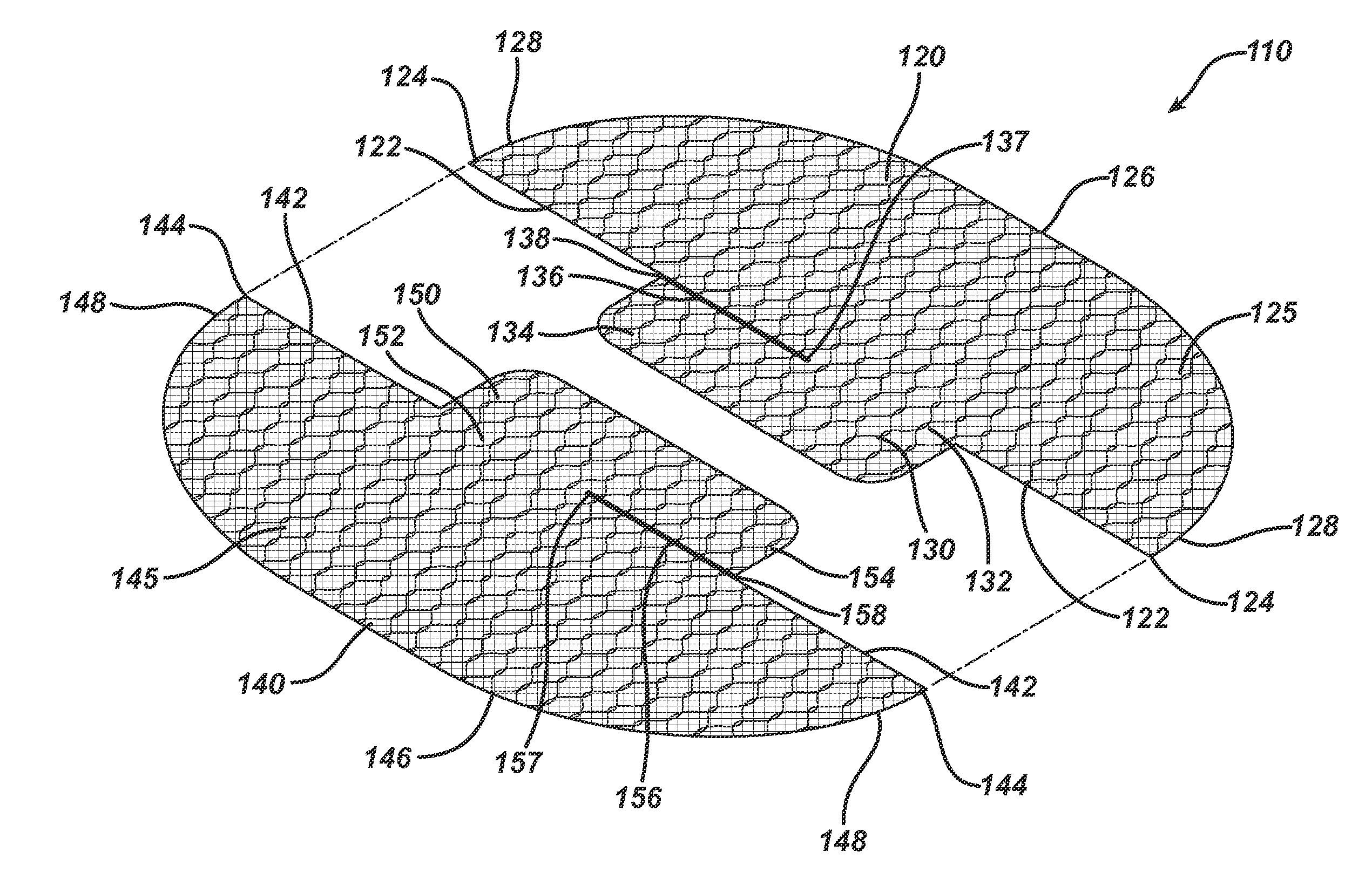 Single plane tissue repair patch having a locating structure