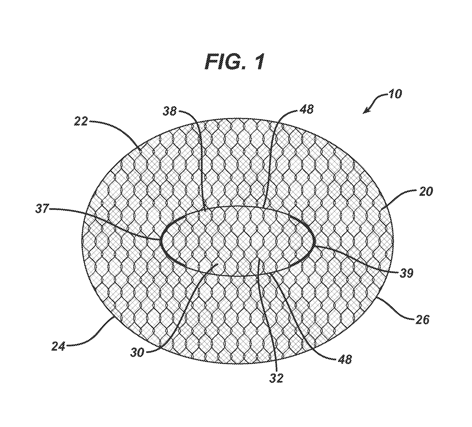 Single plane tissue repair patch having a locating structure