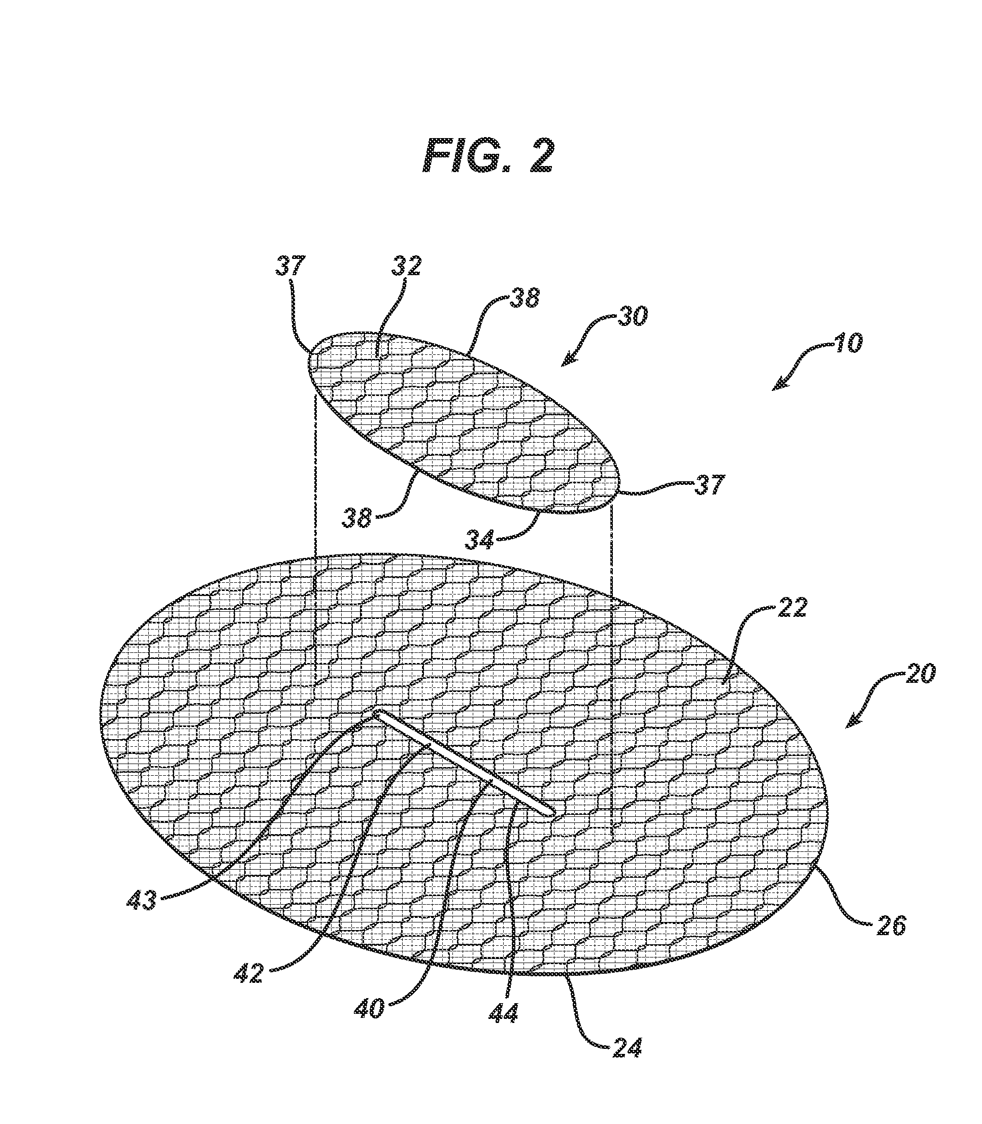 Single plane tissue repair patch having a locating structure