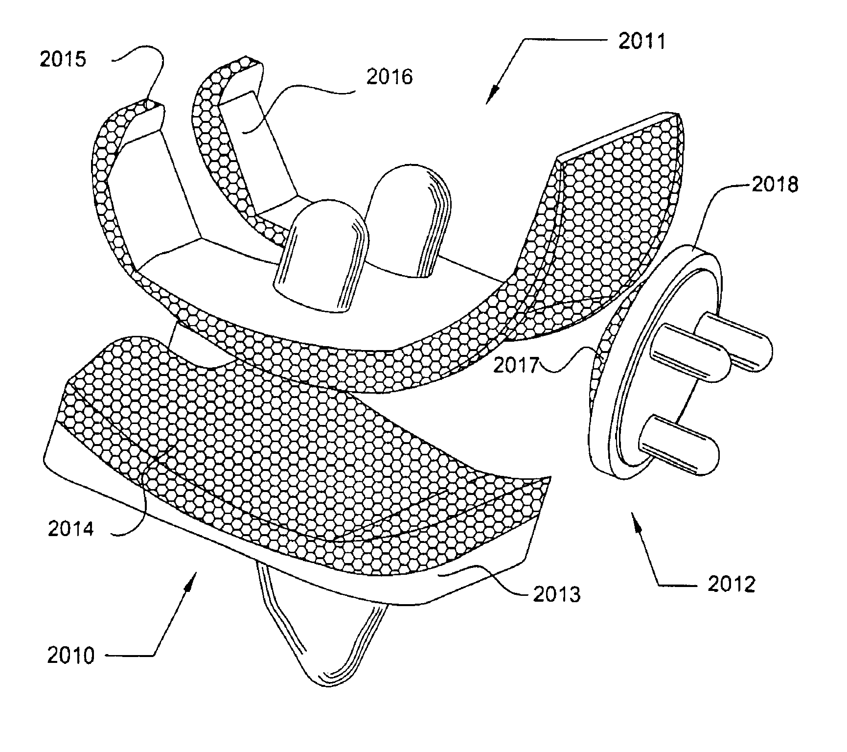 Prosthetic knee joint having at least one diamond articulation surface