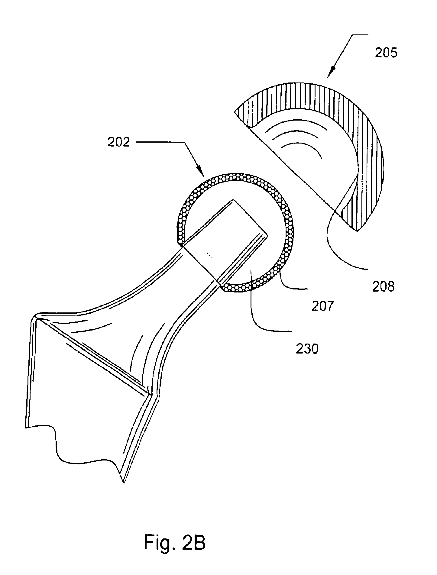 Prosthetic knee joint having at least one diamond articulation surface