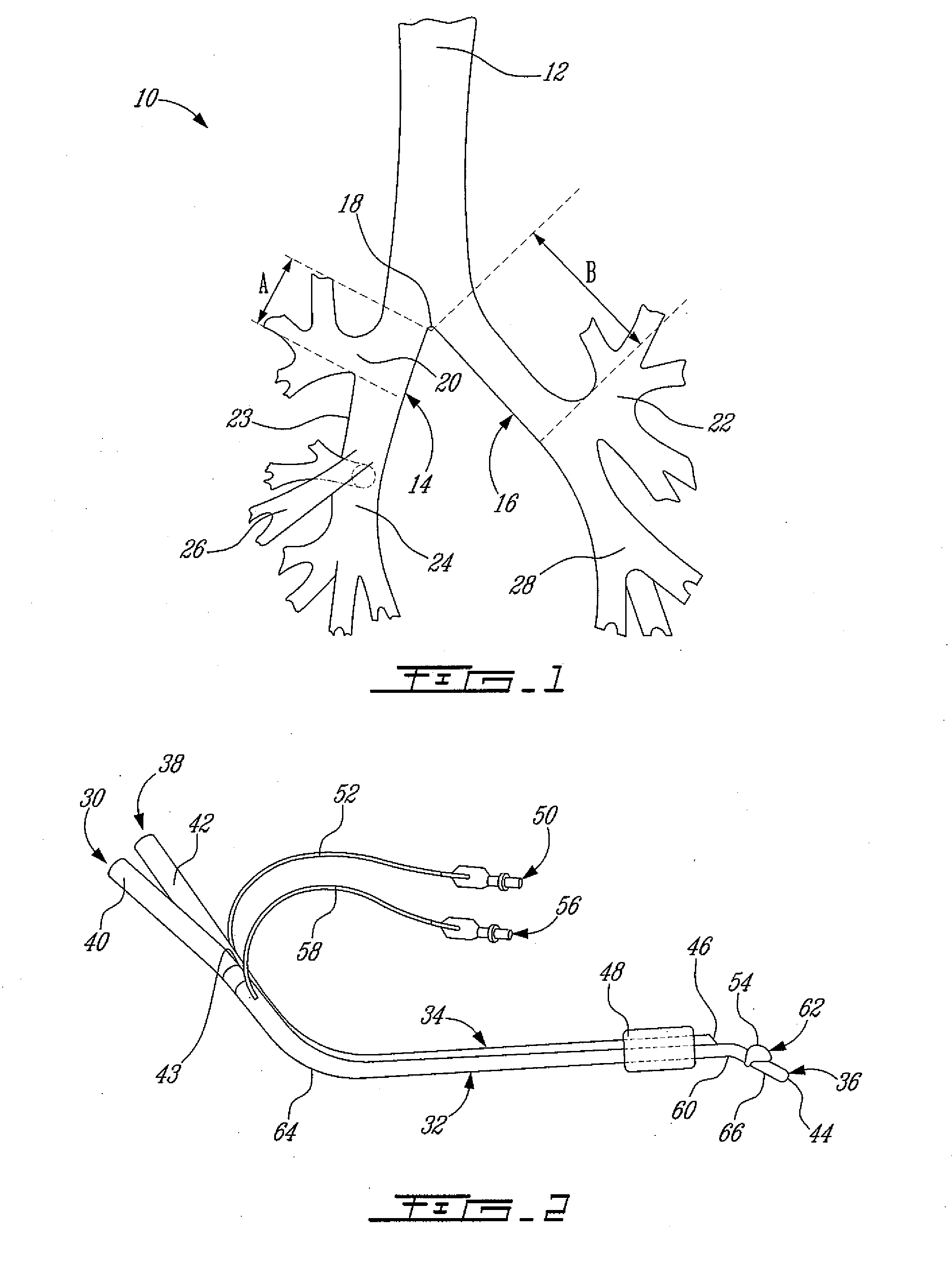 Right double lumen endobronchial tube